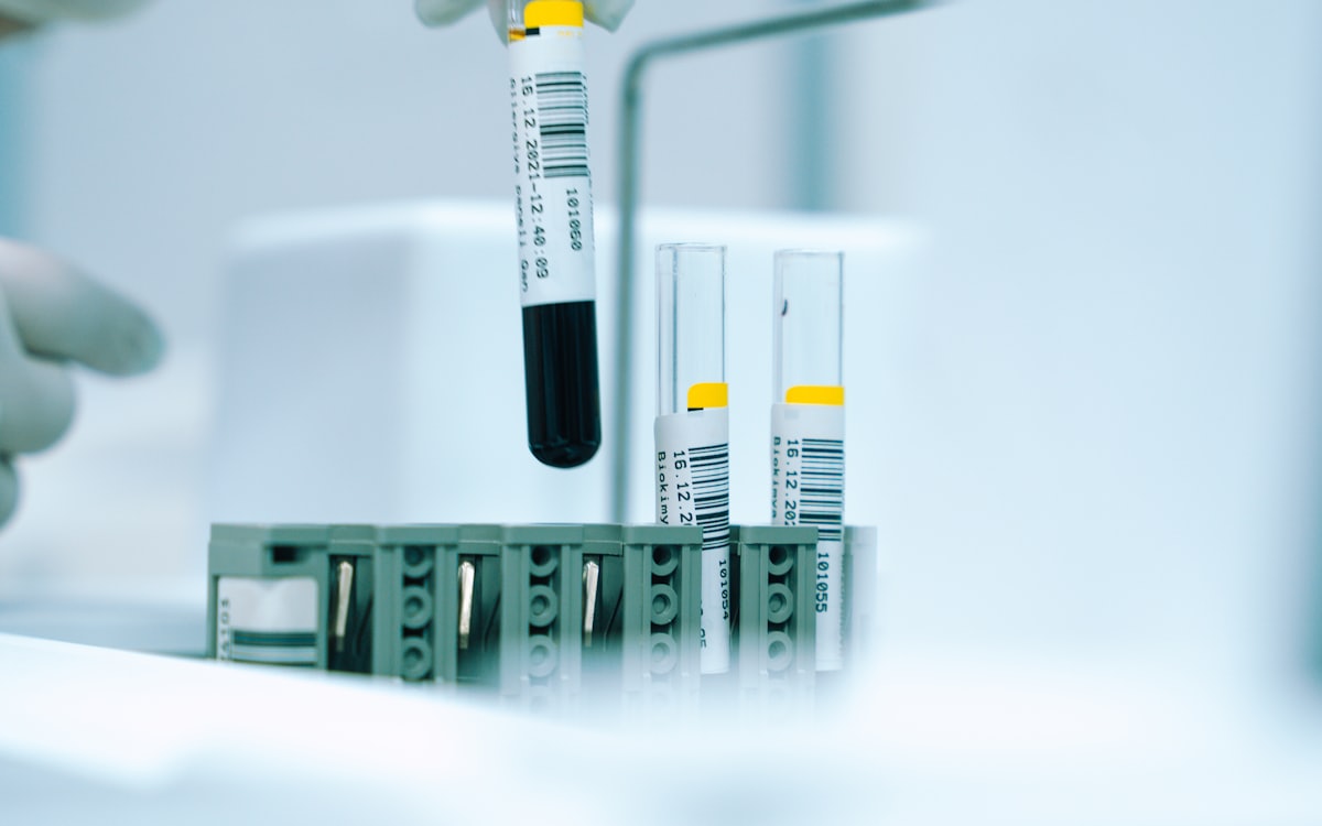Blood samples in a haematology laboratory